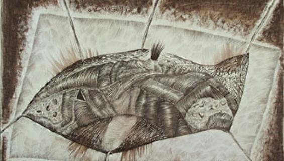 kocsis_rudolf_appendicitis.jpg